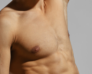 Gynecomastia Surgery